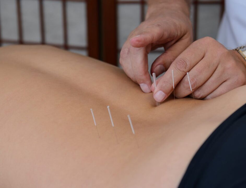 acupuntura para prostatite