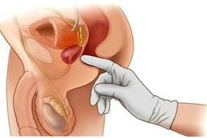 masaxe de próstata para prostatite