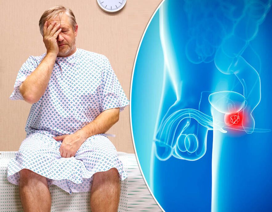 Un home con prostatite está a diagnosticar unha enfermidade